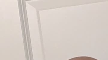 Bald Man Evens Out His Tan Lines