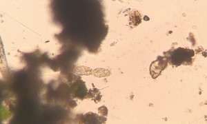 Microscopic Food Chain in Action