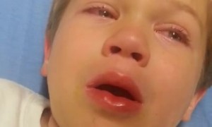 Kid wakes up from surgery - hilariously describes his experience