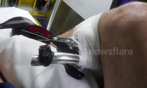 UK cyclist impaled by own bike in freak accident