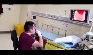 Daredevil doctor performs gastroscopy to check his own stomach