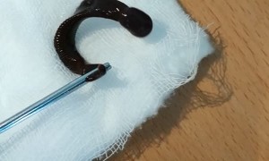 Parasite Pulled from Man's Nose