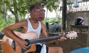 Father's face has swollen to three times its size after mystery disease which 'started as sinusitis'