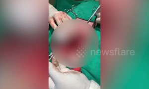 Vets remove 32 RUBBER DUCKS from greedy bulldog's tummy