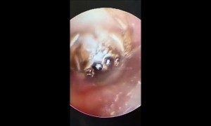 Your worst nightmare! Furry spider spotted living inside woman’s ear