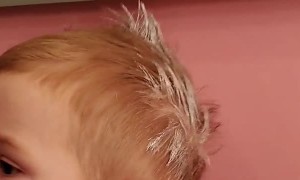 Toddler Unknowingly Puts Rash Cream In Hair