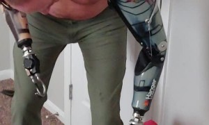 Amputee Dresses with Style