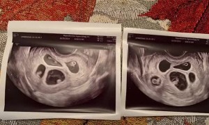 Family Reaction to Surprise Quintuplets