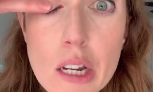 Dentist Visit Leaves Woman With Paralyzed Face