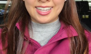 Unexplainable New Accent After Surgery