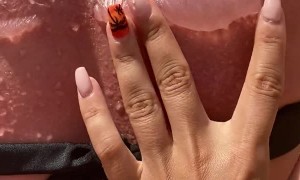 Severe Sunburn Leaves Back Blistered