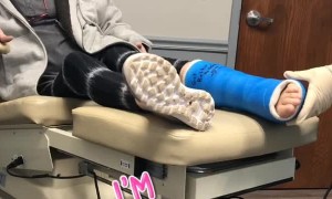 Cast Removal Has Mom Concerned