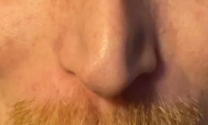 What an Eye Can Look Like After Eye Surgery