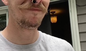 Bee Stings Man From Inside His Nostril