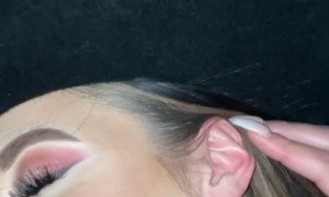 Fully Healed Split Ear Looks Like a Little Mouth