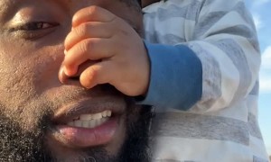 Son Hangs on by a Nose