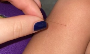 Kid Has One Crazy Long Leg Hair