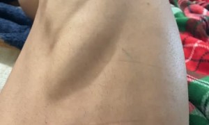 Leg Cramps After Leg Day Rippling