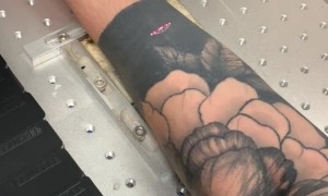 Black Tattoo Laser Branding