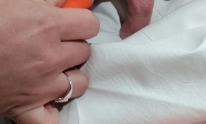 Ring Removal by Tourniquet