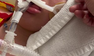 Woman Uses Sign Language to Communicate While in Medically Induced Coma