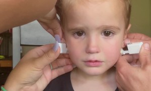 Delayed Reaction to Ear Piercing