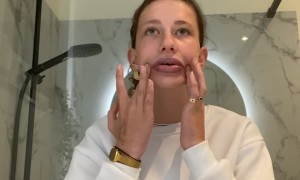 Accidentally Over-Plumped Lips