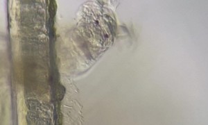 Rotifer Under a Microscope