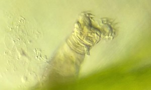 Microscopic Rotifer Spins Cilia