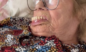 Woman Nearly Loses Her Dentures During Nap