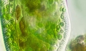 Paramecium Bursaria Eating Cyanobacteria