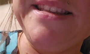 Temu Photo Banner Fail