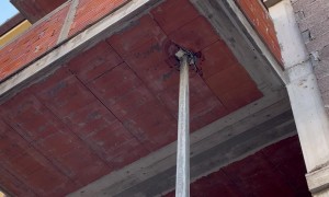 Oddly Placed Pole Looks Like Ingrown Hair