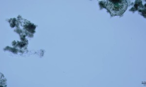 Amoeba Consuming a Single Celled Organism