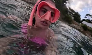 A Jellyfish Stings Me on the Face