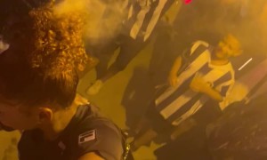 Fan's Hair Catches Fire