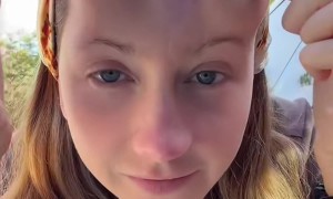 Bulbous Tissue Expanders Help Scars Heal