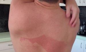 And How Exactly Did You Apply the Sunscreen?