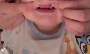 Baby With Vampire Teeth