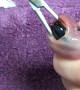 Huge Stone Stuck in Axolotl's Throat