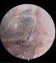 Tiny spider found building a nest in man’s ear in China in stomach-churning clip