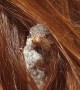 Sparrow Nests in Woman's Hair