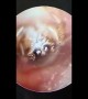 Your worst nightmare! Furry spider spotted living inside woman’s ear