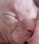 Sphynx Kitten Sucking Thumb
