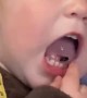 Parent Pulls Tiny Pest From Toddler's Mouth