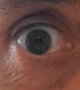 Man Dilates Pupils on Demand