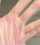 Fitting 6 Fingers into a Latex Glove