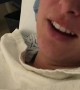 Funny Wisdom Teeth Removal Aftermath