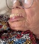 Woman Nearly Loses Her Dentures During Nap