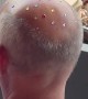 Man Bejewels Balding Head For Eras Tour